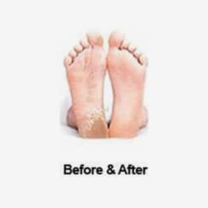 Baby Foot: Before & After