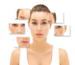 Hyperpigmentation Treatment in Raleigh NC | Skin & Cosmetic Solutions